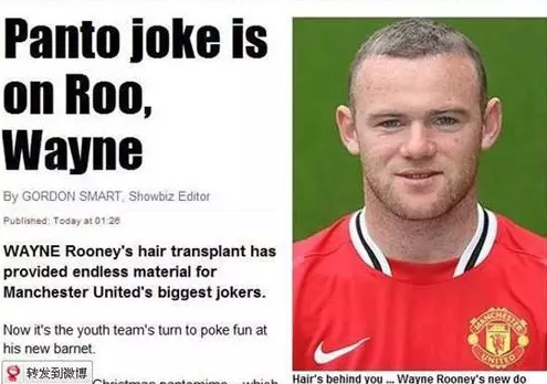 鲁尼植发_鲁尼植发后为什么又脱发了